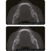Томограф Eighteeth FinScan F350 16×10 с цефалостатом
