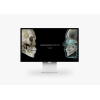 HDX Will DENTRI 3D дентальный томограф 18x16,5 с цефалостатом